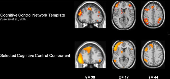 Decision-Making and Cognitive Control Networks